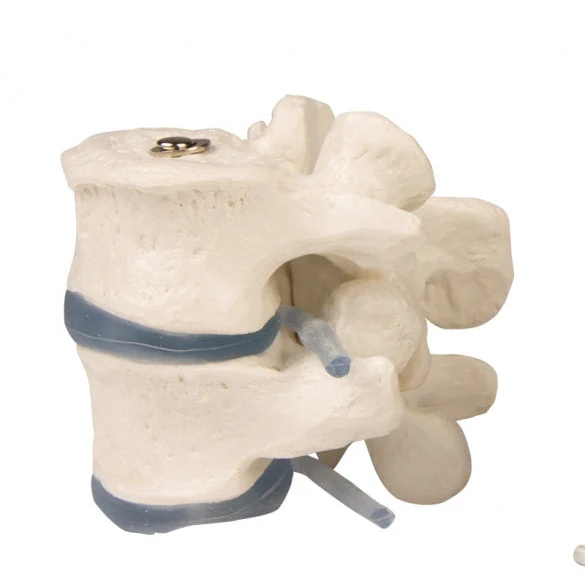 2 Lumbar Vertebrae