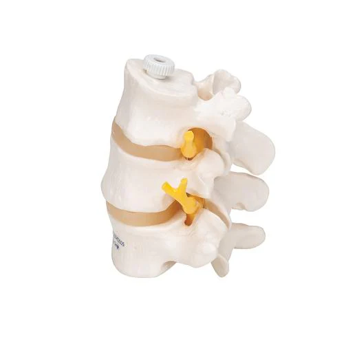 3 Human Lumbar Vertebrae, Flexibly Mounted - Image 2