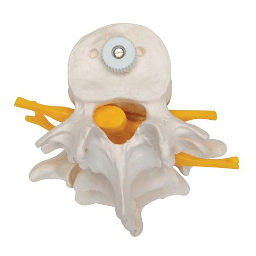 3 Human Lumbar Vertebrae, Flexibly Mounted - Image 3