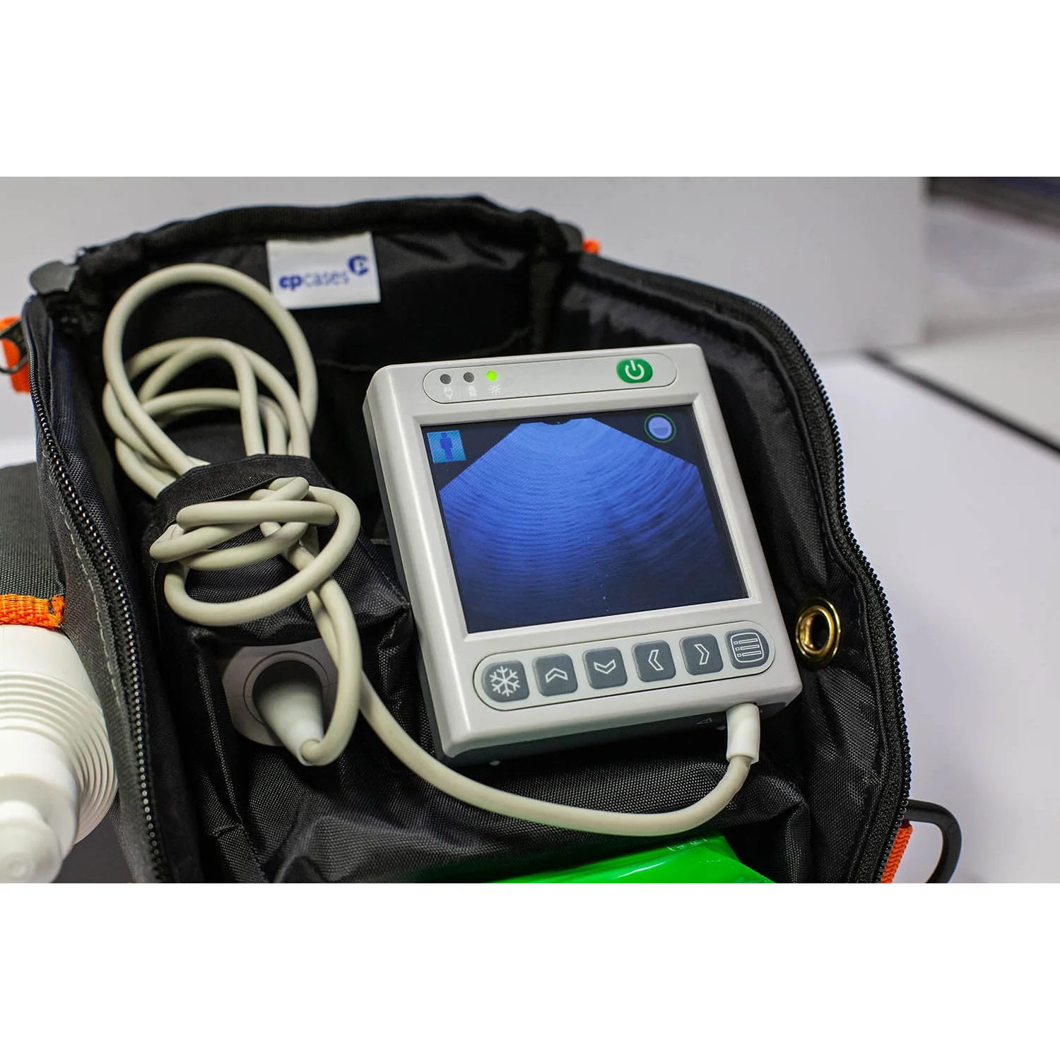 3D Bladder Scanner - Image 5
