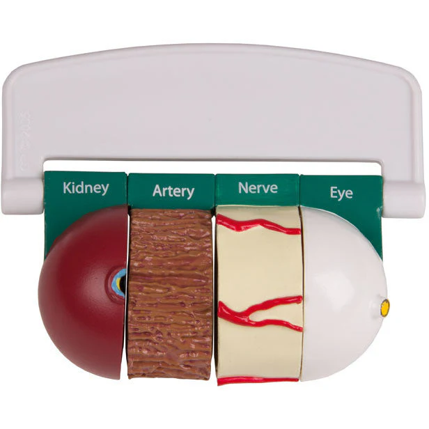 4-Piece Diabetes Model