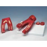 Arteriosclerosis Model - Image 2