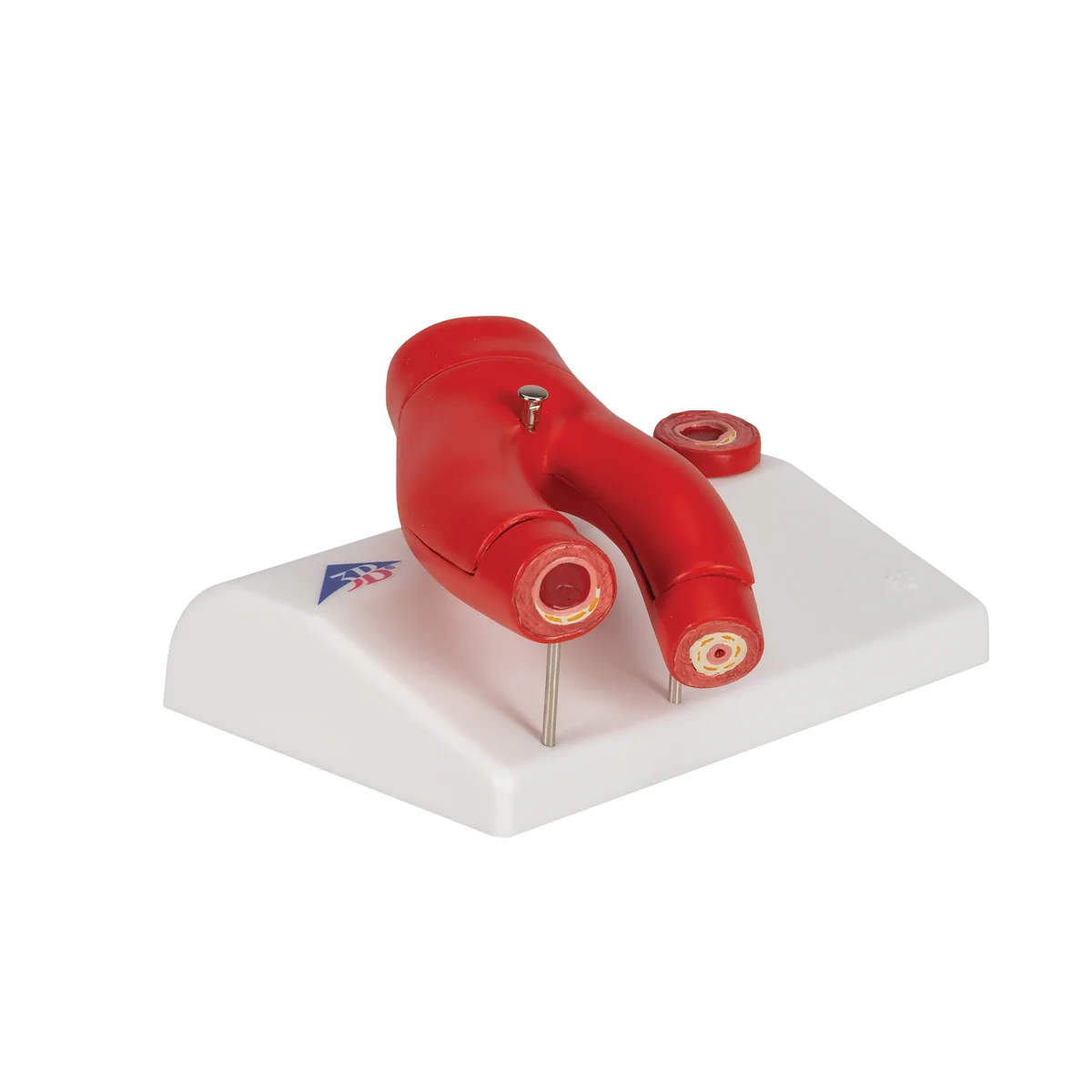 Arteriosclerosis Model, with Cross Section of Artery, 2 part - Image 3