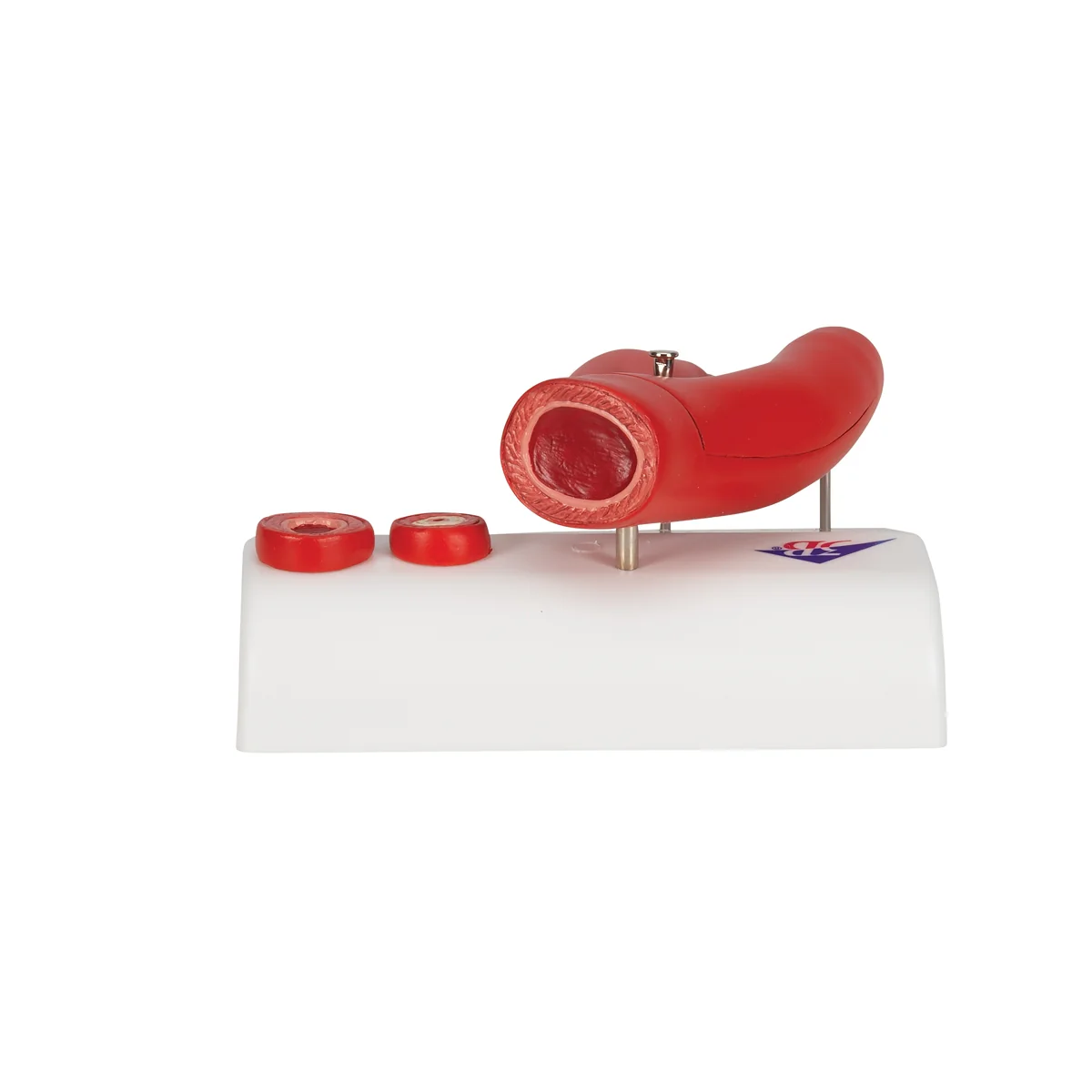 Arteriosclerosis Model, with Cross Section of Artery, 2 part - Image 4
