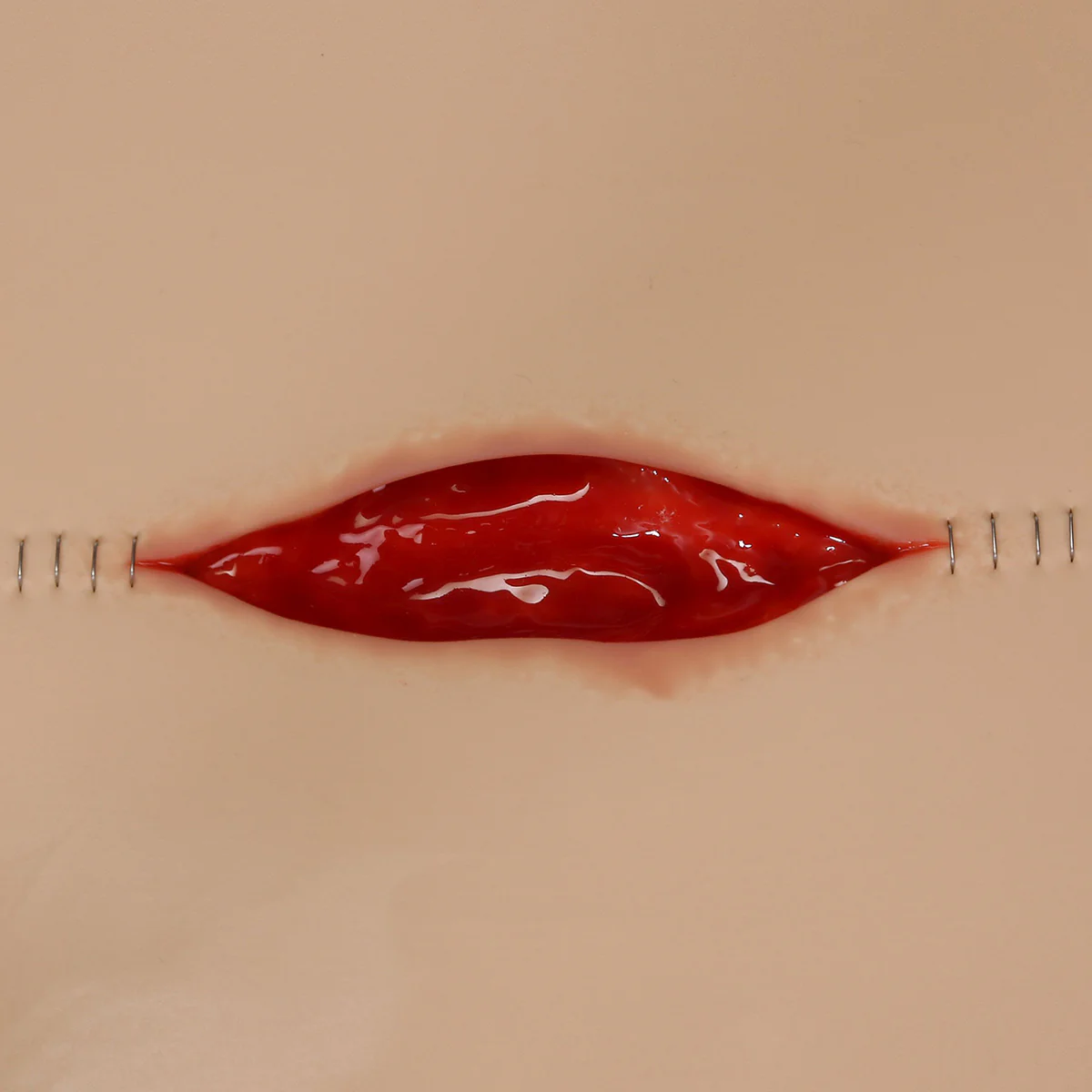 Dehisced Wound Board, light - Image 3