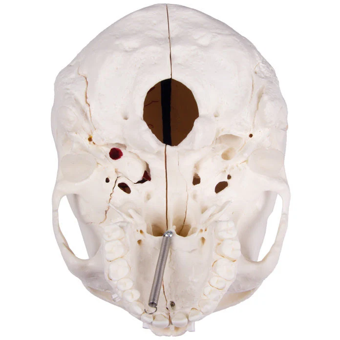 Deluxe Demonstration Skull - 14 Part For Advanced Studies - Image 4