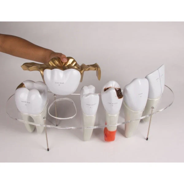 Dental Morphology Series - 7-Part - 10 Times Life-Size - Image 2
