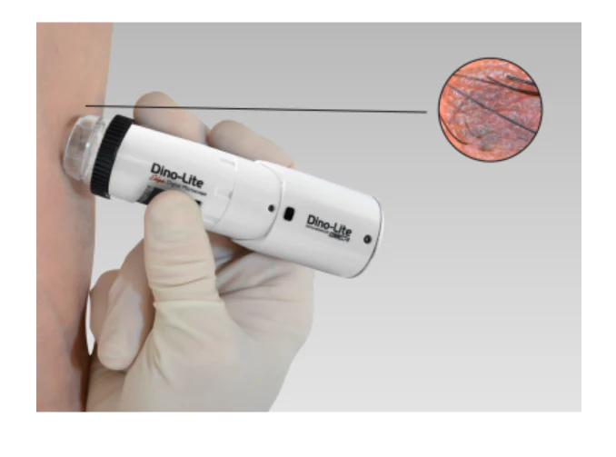DermaScope Polarizer Wireless - Image 2