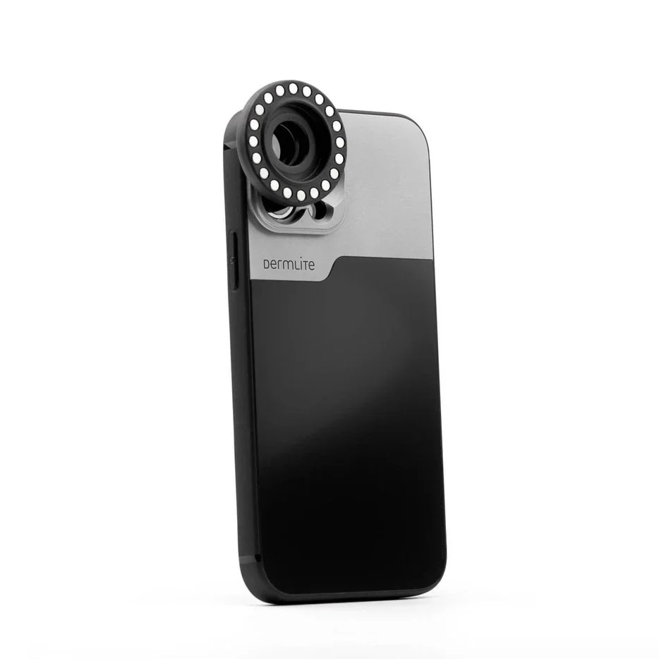 DermLite Connection Kit for IPhone 14 Pro - Image 3