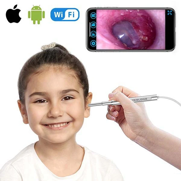Digital Otoscope - Camera Diameter: 4.3mm + WiFi - iPhone / iPad / Android