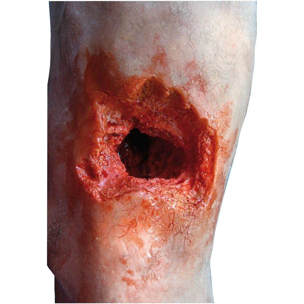 Emergency Leg - Image 2