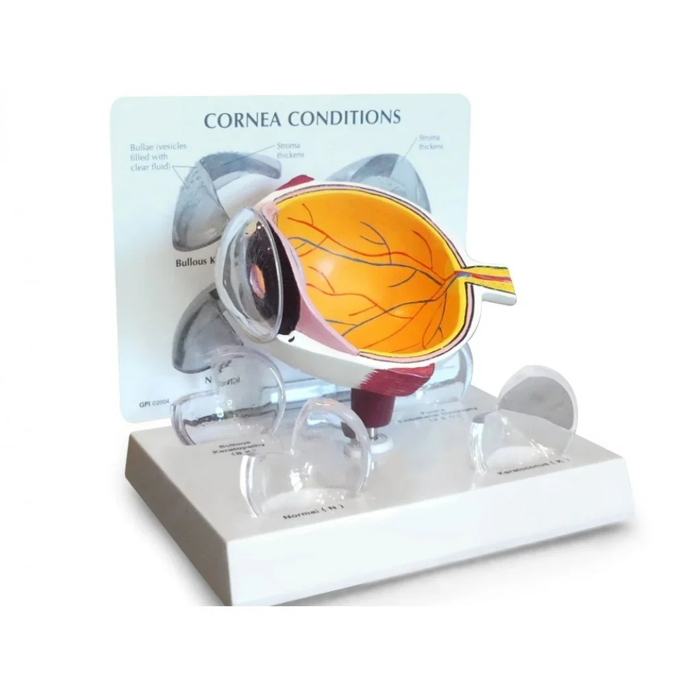 Eye Anatomy & Pathology Collection - Image 3