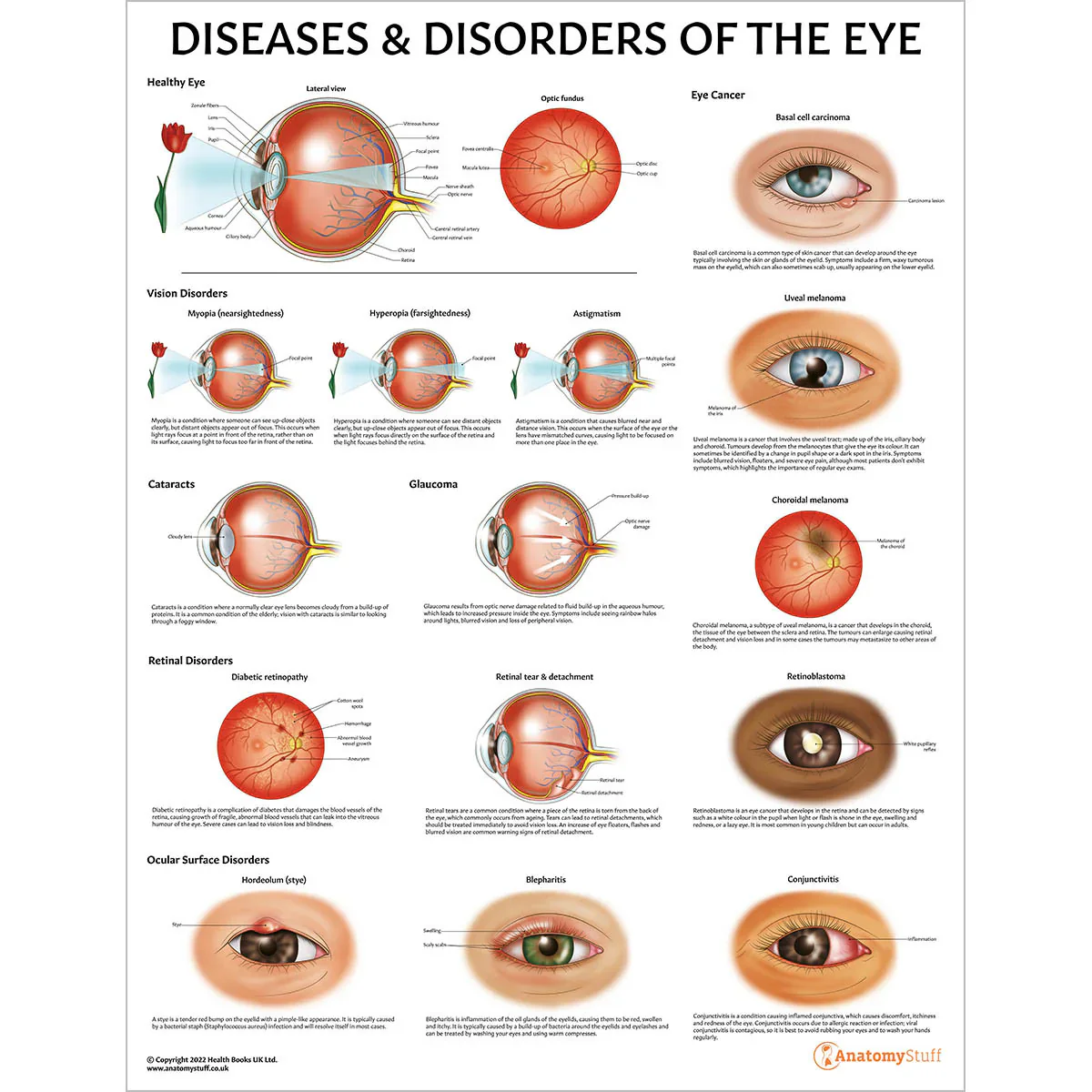 Eye Anatomy & Pathology Collection - Image 7