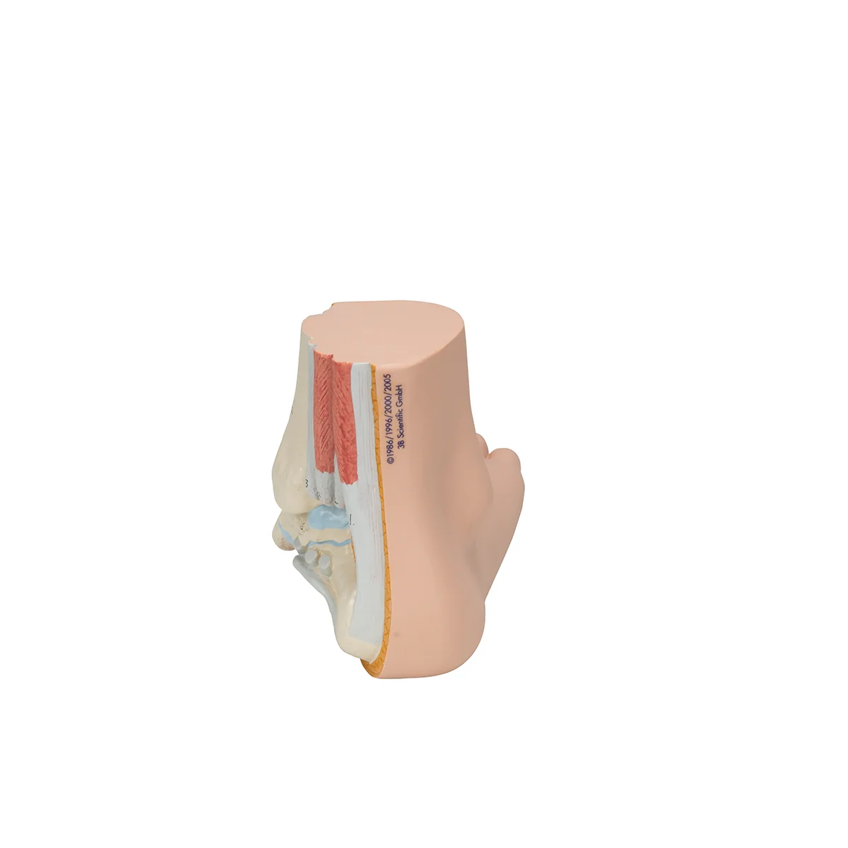 Flat Foot (Pes Planus) Model - Image 3