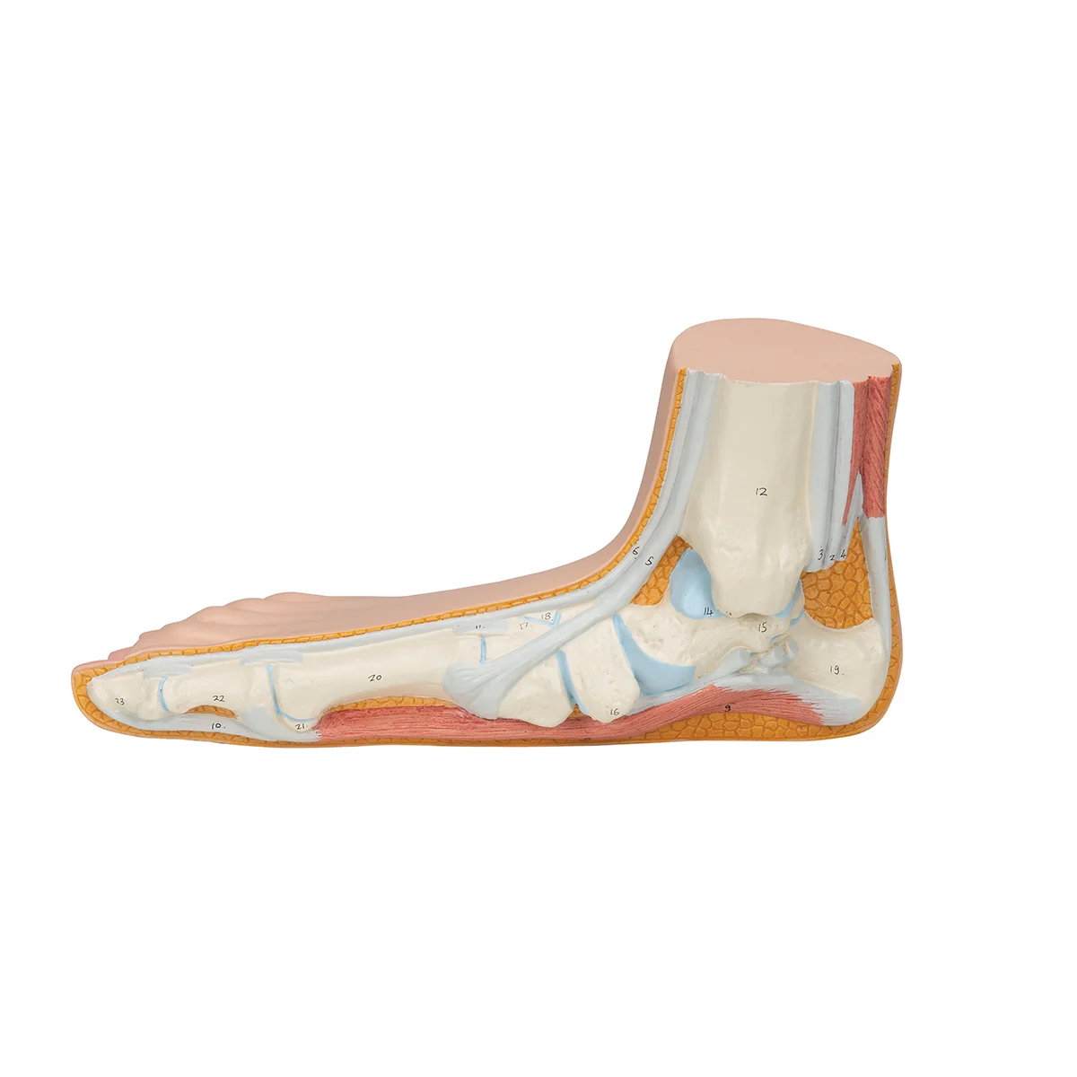 Flat Foot (Pes Planus) Model - Image 4