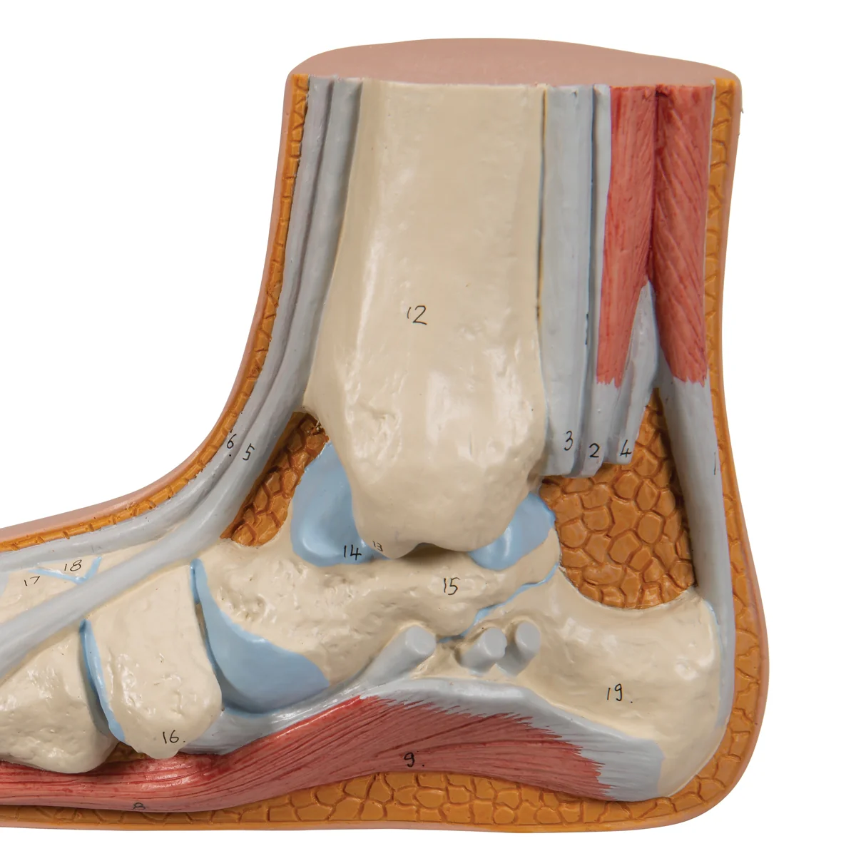 Flat Foot (Pes Planus) Model - Image 5