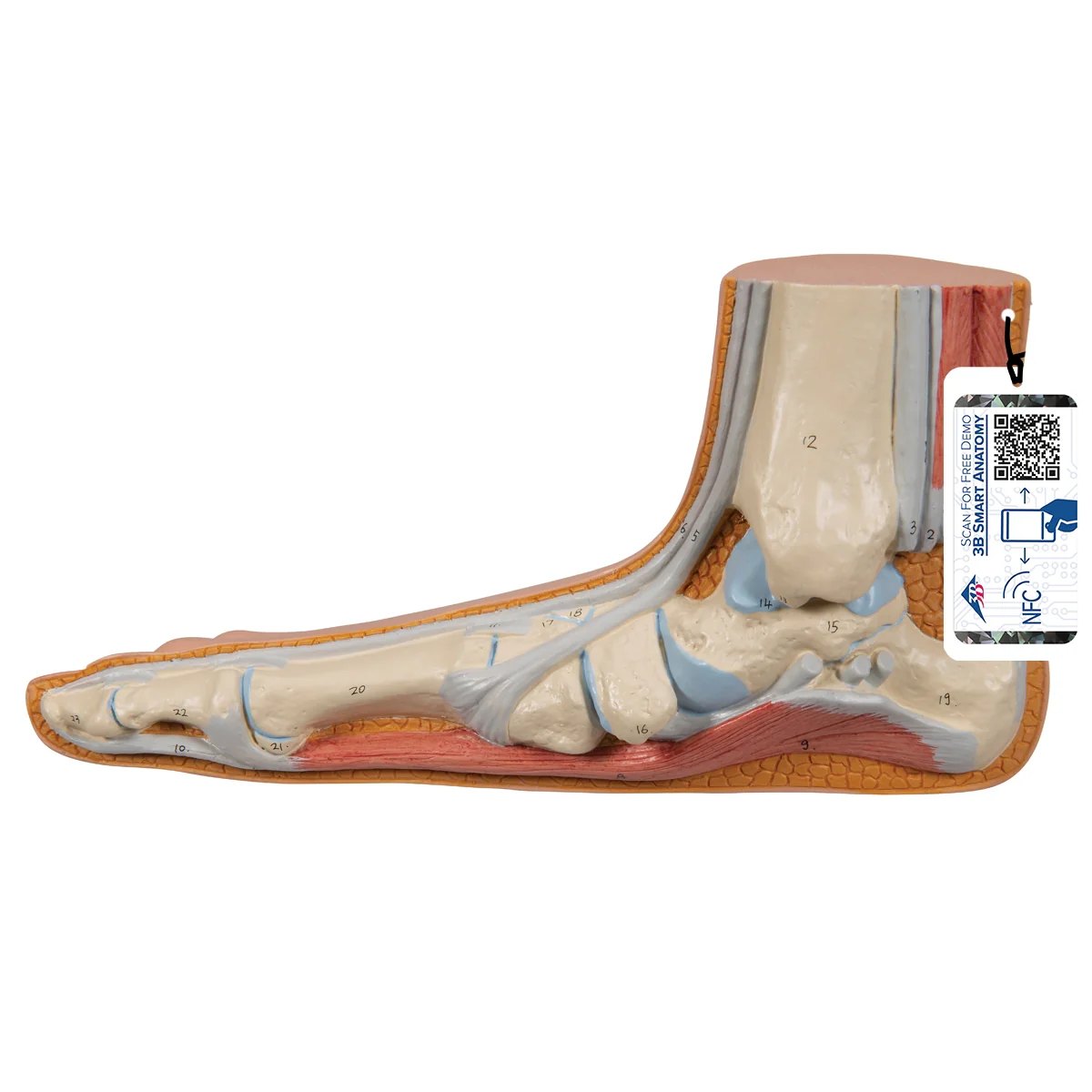 Flat Foot (Pes Planus) Model - Image 7