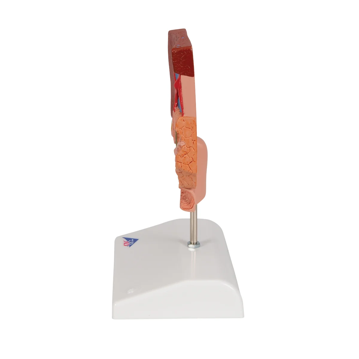 Gallstone Model - Image 2