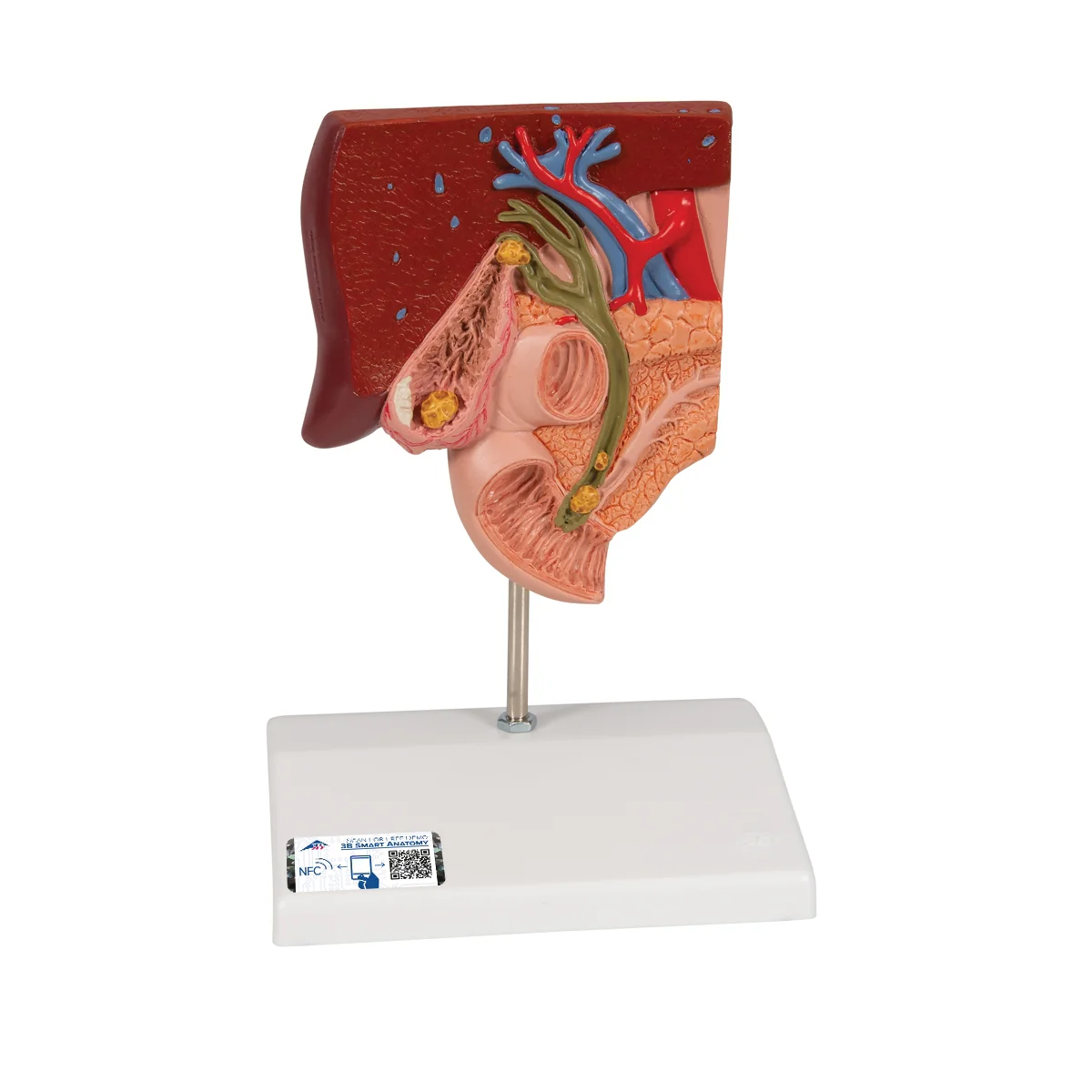 Gallstone Model - Image 3