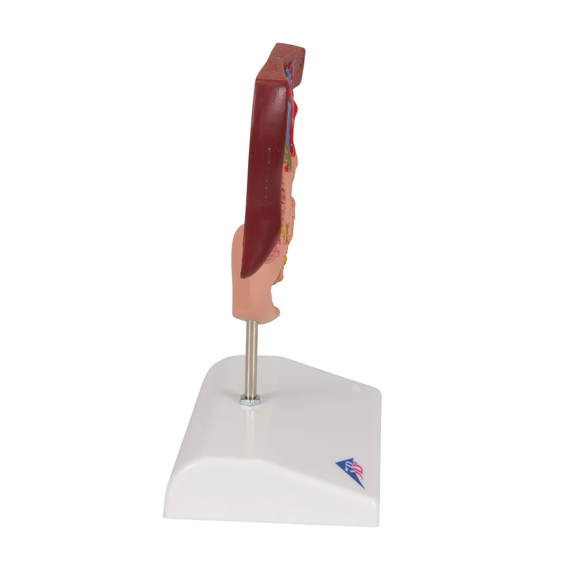 Gallstone Model - Image 4