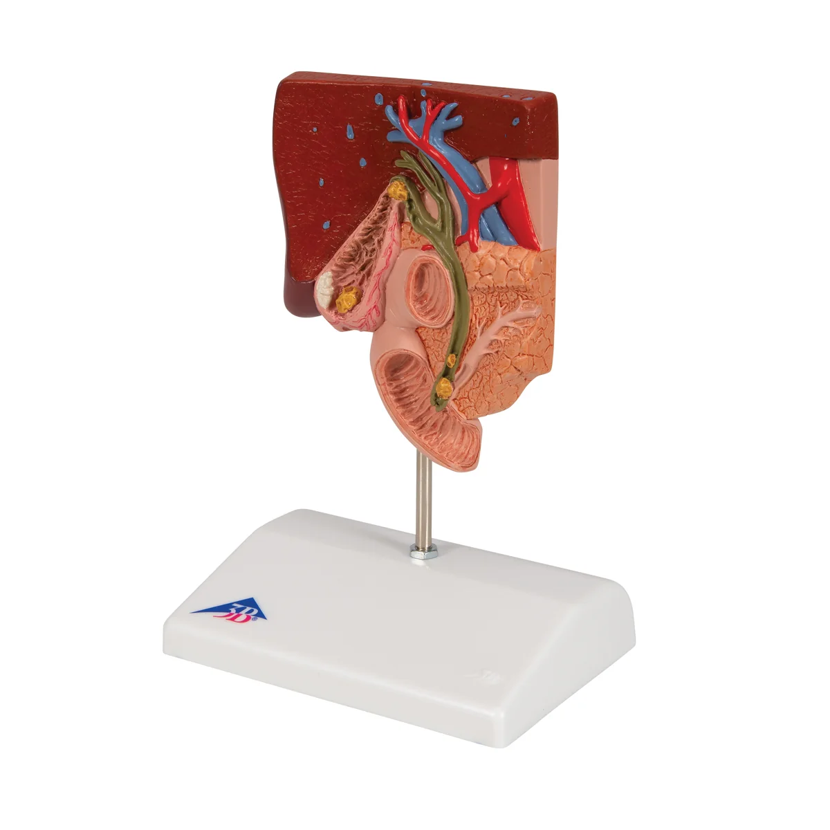 Gallstone Model - Image 5