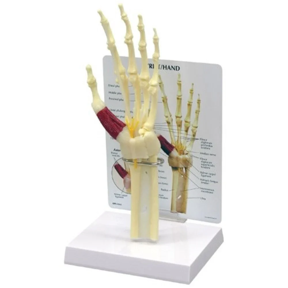 Hand & Wrist Anatomy & Pathology Collection - Image 4