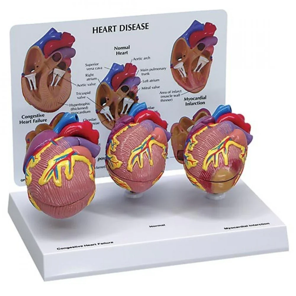 Heart Anatomy & Pathology Collection - Image 4