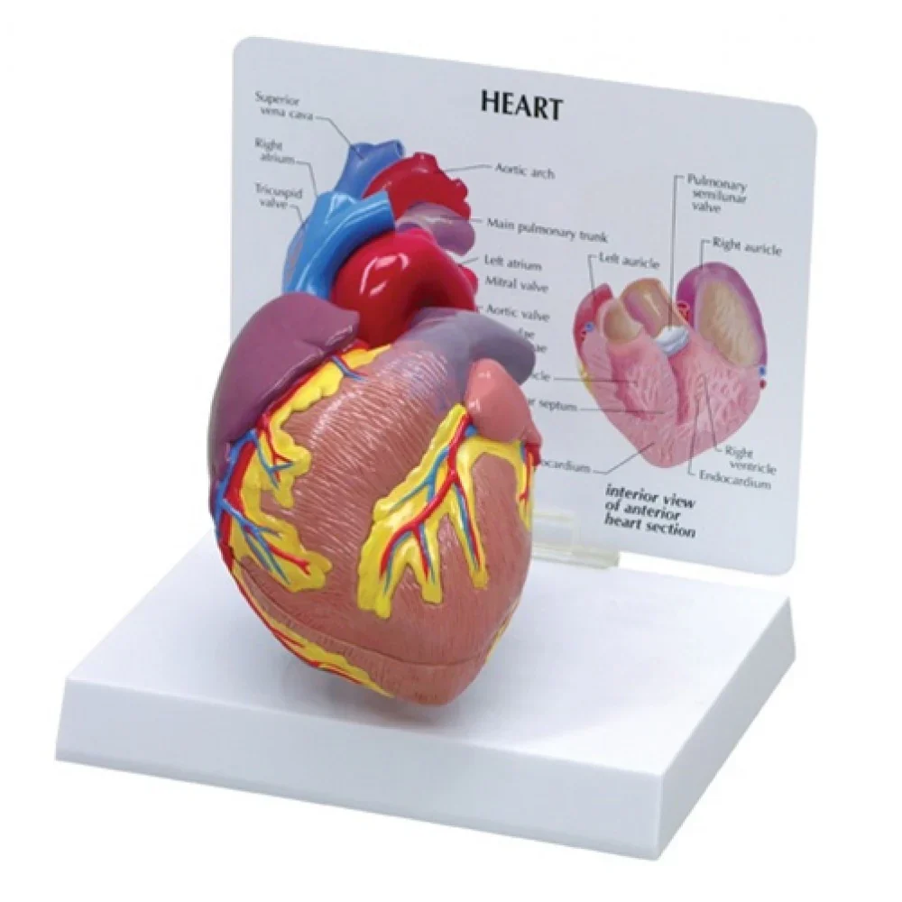 Heart Anatomy & Pathology Collection - Image 5
