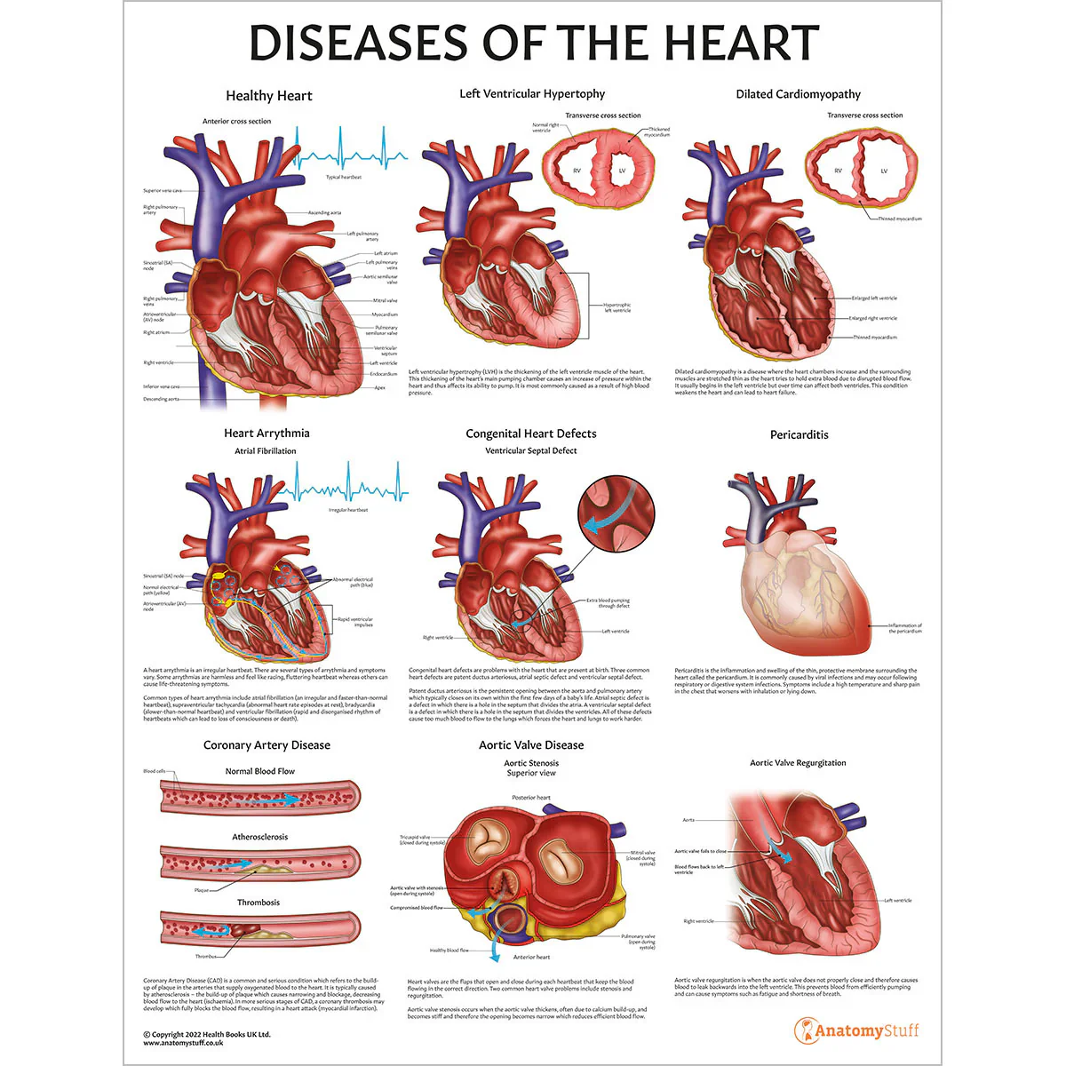 Heart Anatomy & Pathology Collection - Image 6