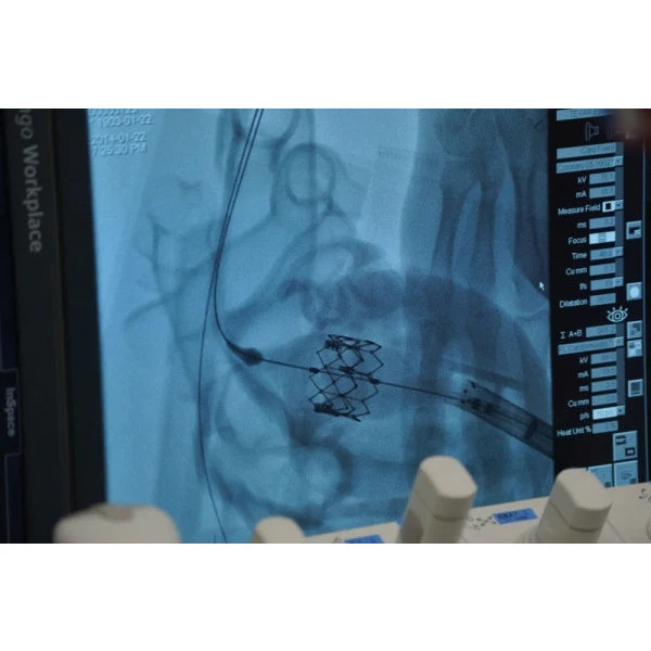 Heart Model - Professional - Clear - Image 2