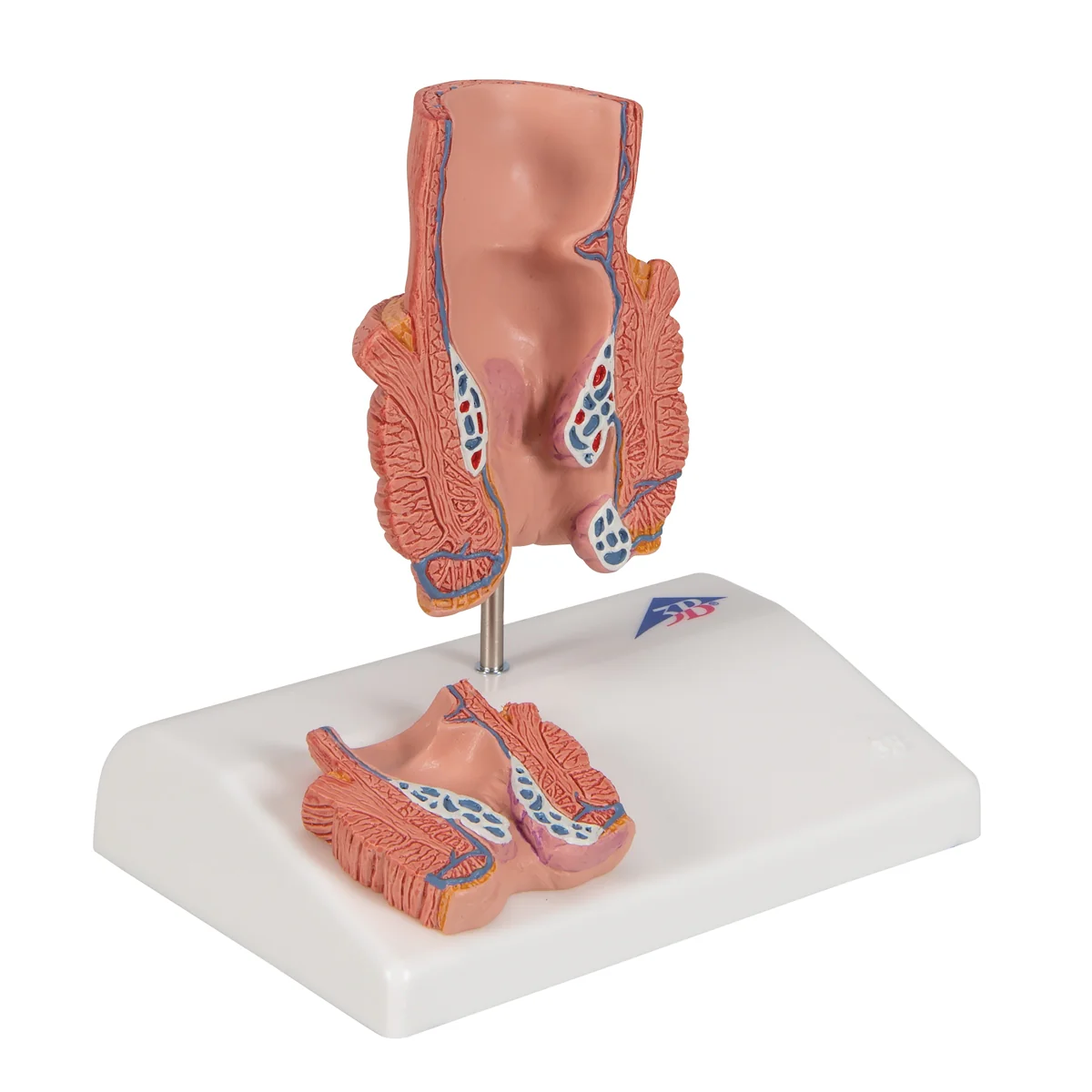 Hemorrhoid Model - Image 2