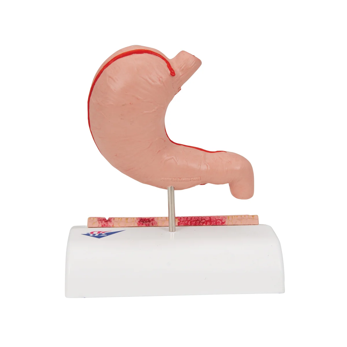 Human Stomach Section Model with Ulcers - Image 3