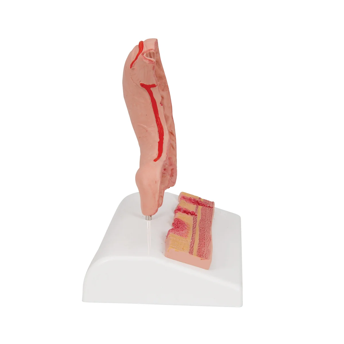 Human Stomach Section Model with Ulcers - Image 4
