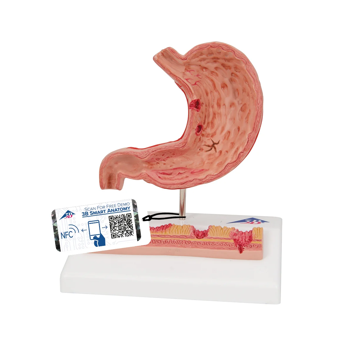 Human Stomach Section Model with Ulcers - Image 7