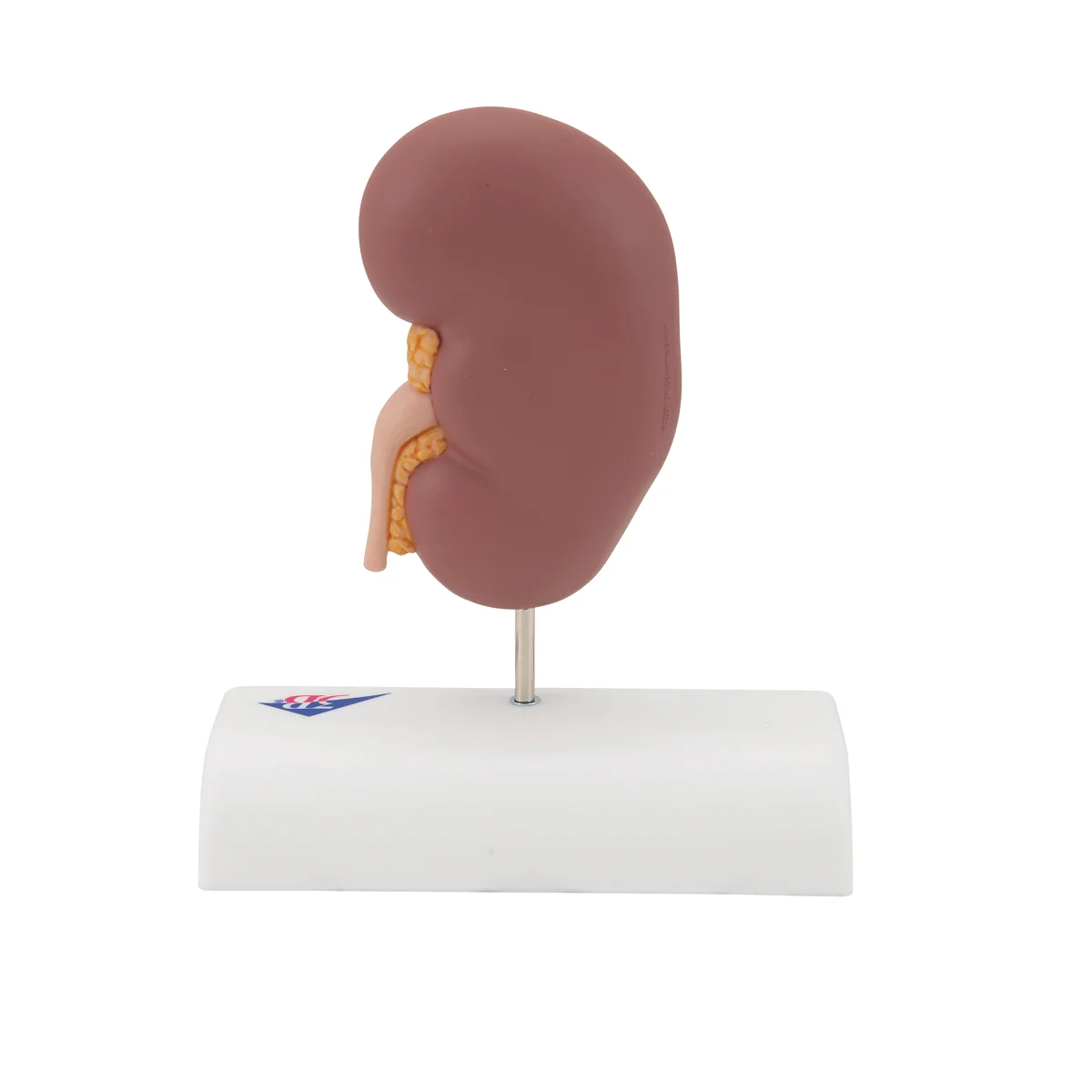 Kidney Stone Model - Image 4