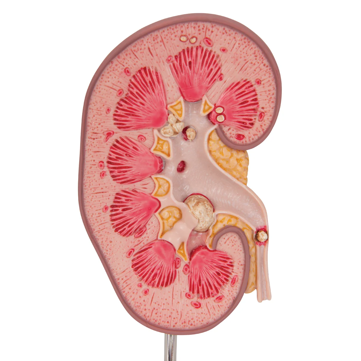 Kidney Stone Model - Image 6