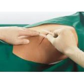 Leukostrip Wound Closure 6.4mm x 76mm per Pack of 3 - Image 3