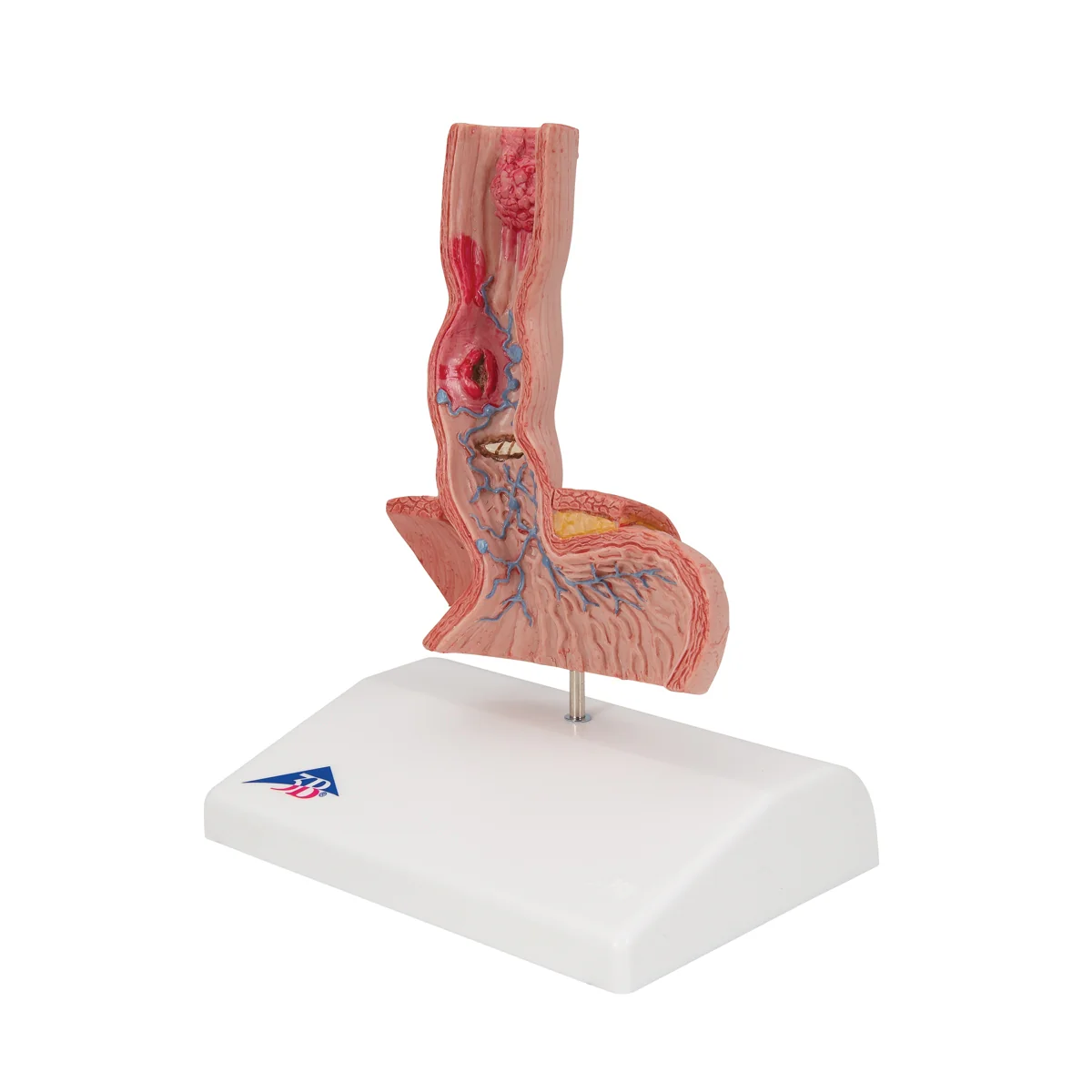 Life-Size Human Esophagus Diseases Model - Image 3