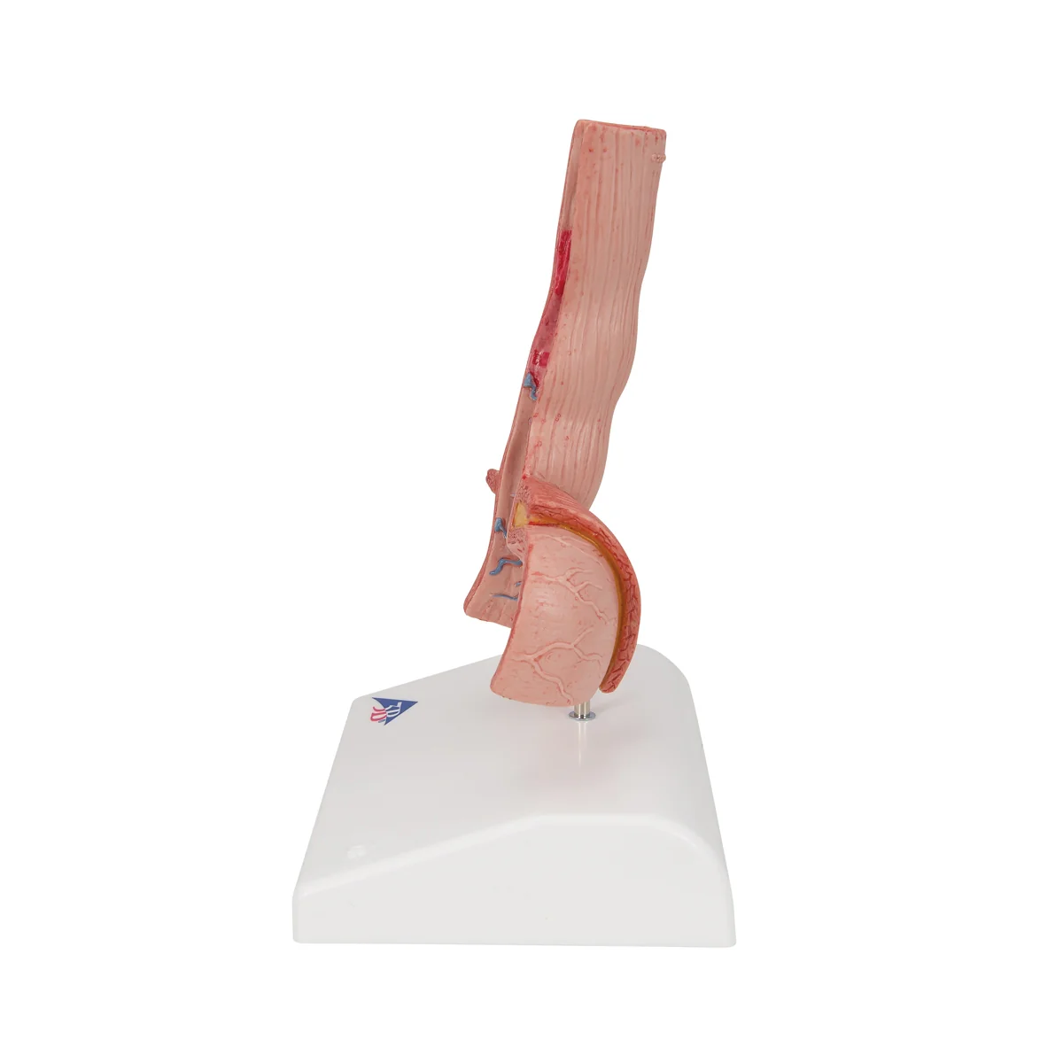 Life-Size Human Esophagus Diseases Model - Image 4