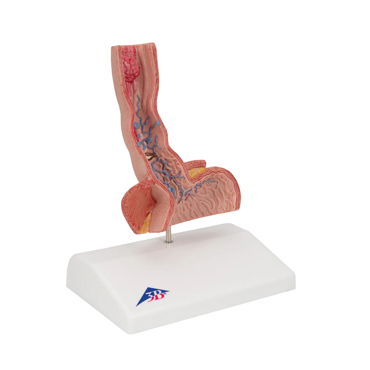 Life-Size Human Esophagus Diseases Model - Image 6