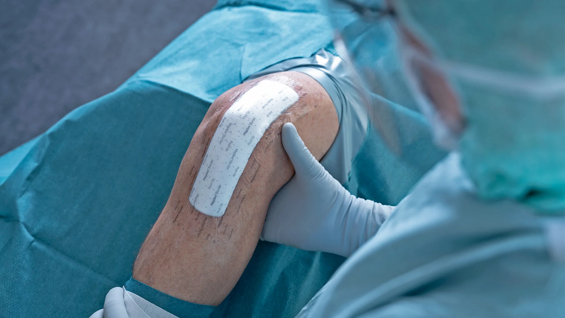 Mepilex Boarder Post Op Dressing - 10cm x 15cm - Box of 10 - Image 4