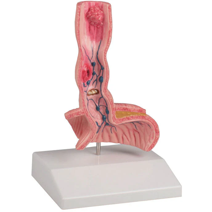 Oesophagus Diseases