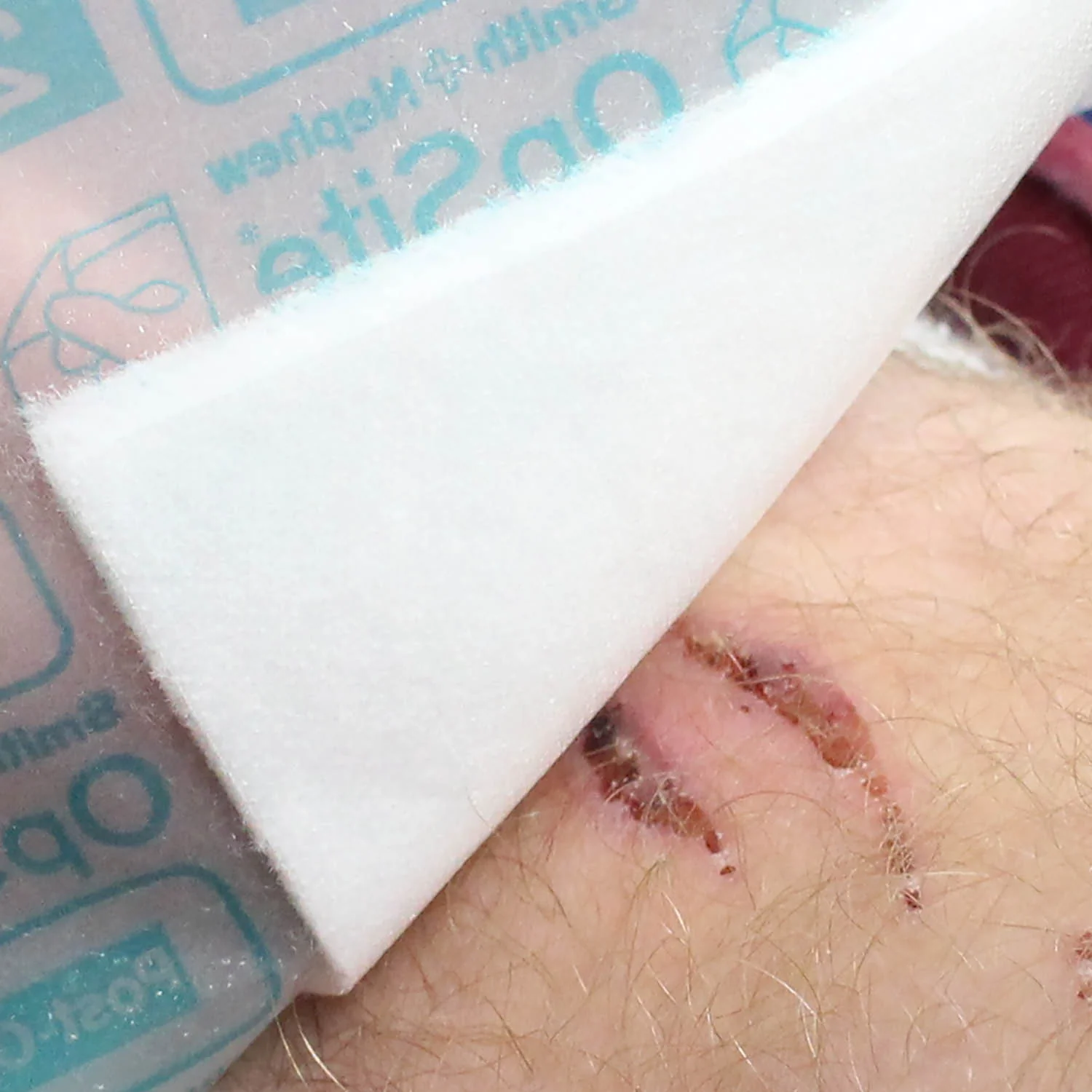 OPSITE Post-Op Dressing 20 x 10cm - Pack of 20 - Image 4