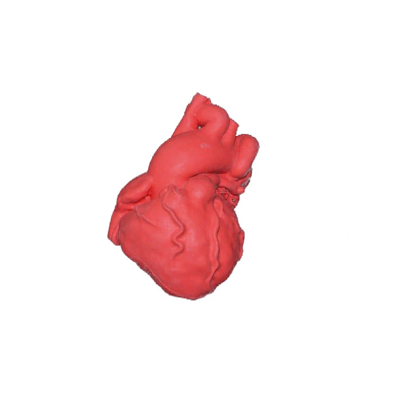 Pediatric Heart with Tetralogy of Fallot (TOF)