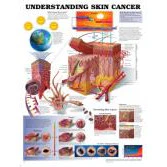 Poster: Understanding Skin Cancer - Image 2