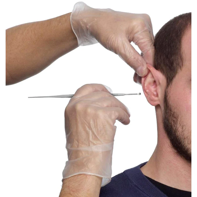 Propulse ProScoop Ear Wax Removal Scoop x 40 - Image 3