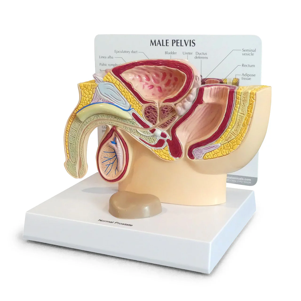 Prostate Anatomy & Pathology Collection - Image 3