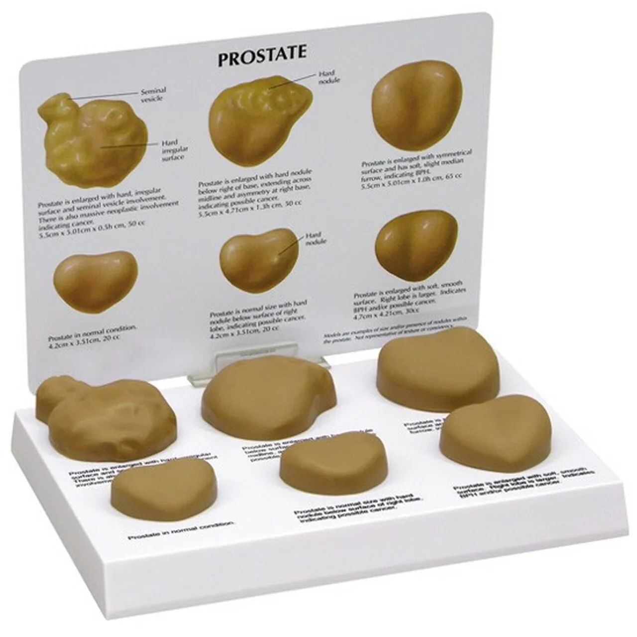 Prostate Anatomy & Pathology Collection - Image 4