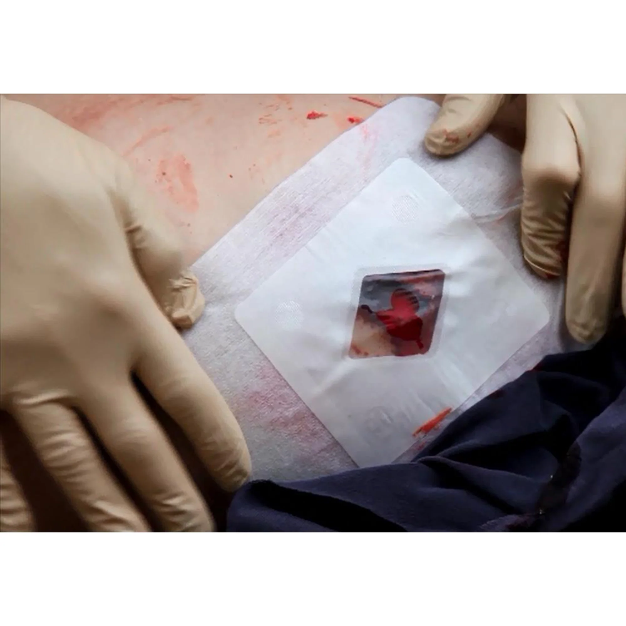 Russell Chest Seal (RCS) - Image 4
