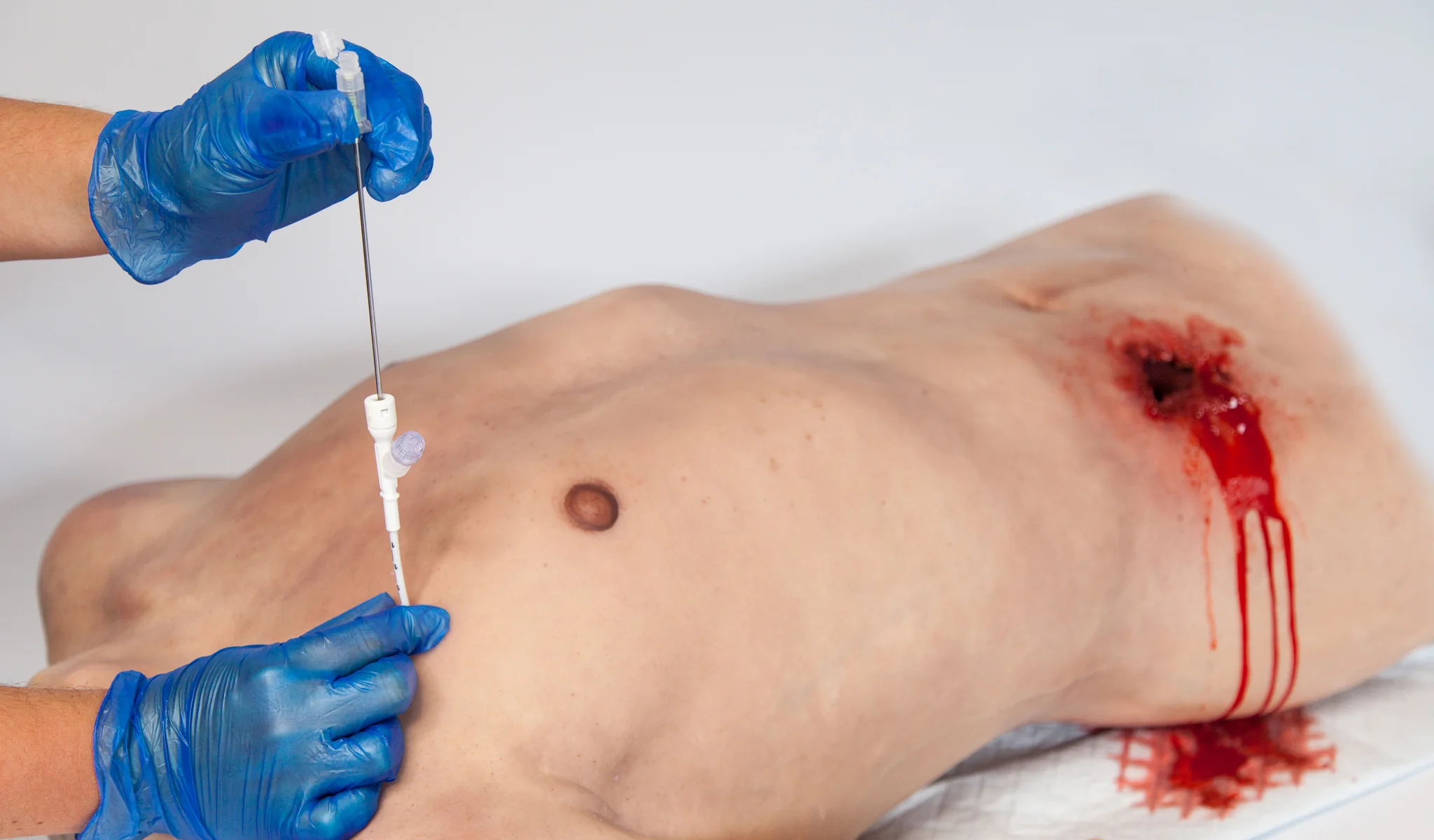 Russell PneumoFix Veress Tipped Needle - Long - 11cm - Image 3